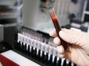 Blood in test tube