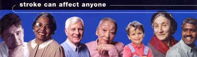 Stroke can affect anyone