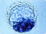 Image of a blastocyst