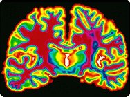 Brain scan image